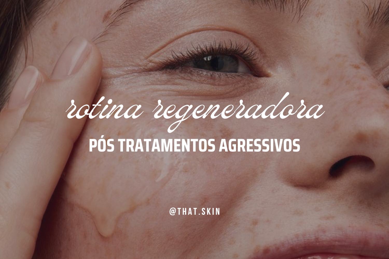 Rotina Regeneradora Pós Tratamento Estético