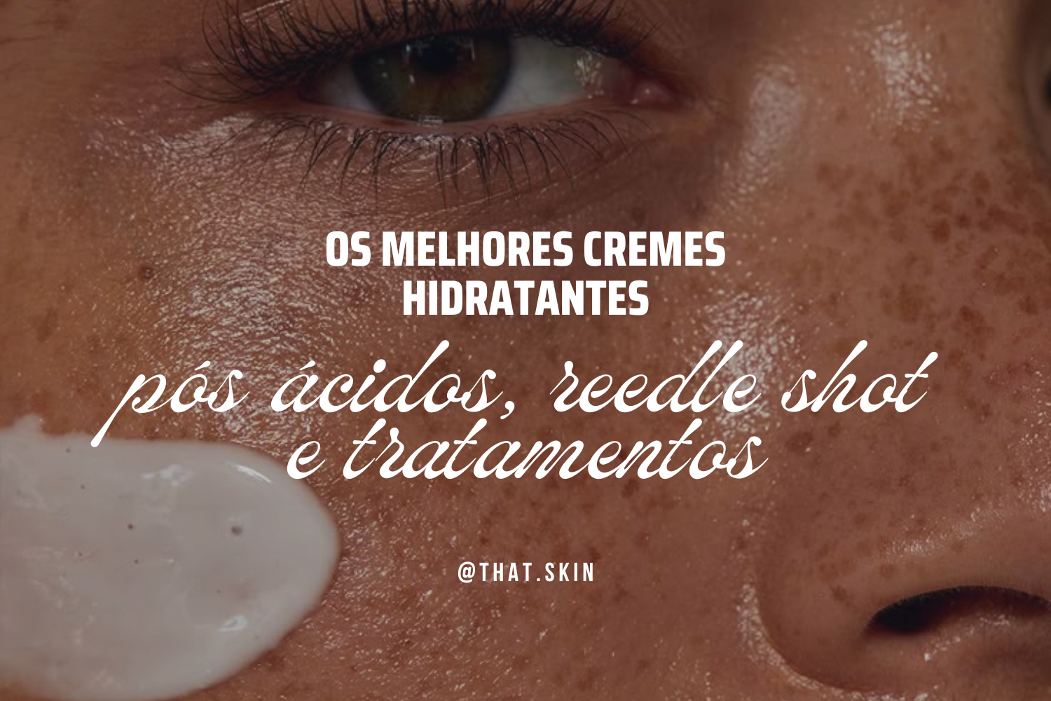 Os Melhores Cremes Hidratantes Pós Ácidos, Reedle Shot e Tratamentos